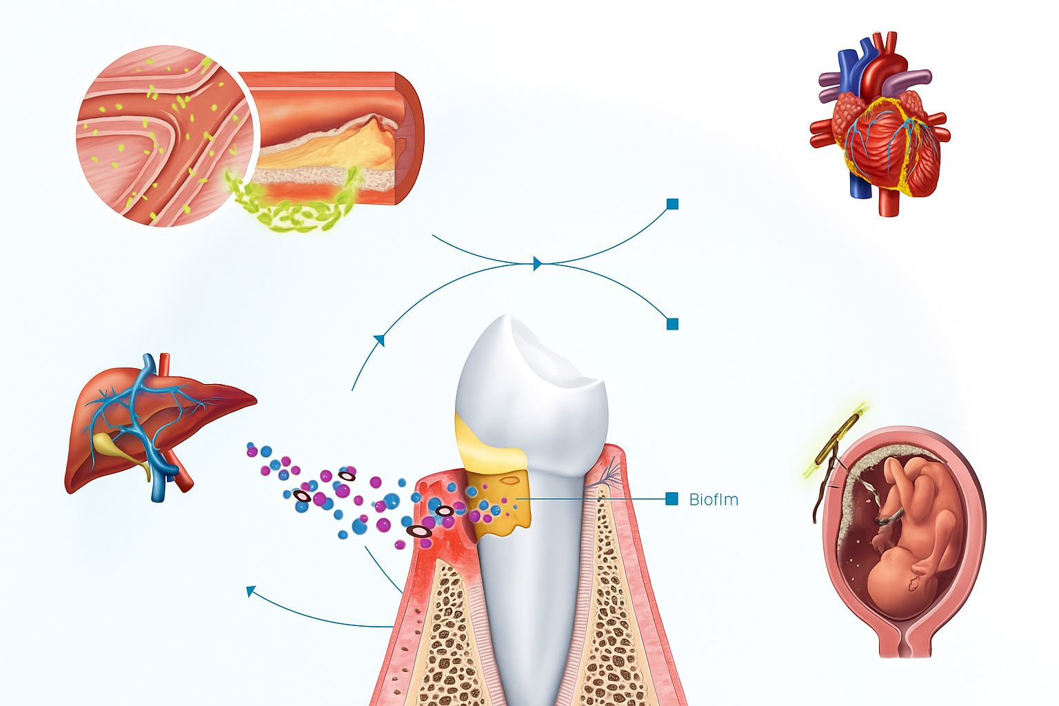 Periodontitisin Sistemik Hastalıklara Etkisi: Kanıta Dayalı Çift Yönlü İlişki
